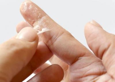 پاک کردن چسب قطره ای از روی دست